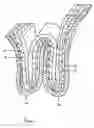 Fig. 02 - Methods and apparatus for excising tissue and creating wall-to-wall adhesions from within an organ