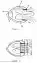 Fig. 03 - Methods and apparatus for excising tissue and creating wall-to-wall adhesions from within an organ