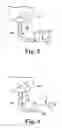 Fig. 03 - Anastomosis device configurations and methods