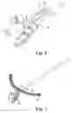 Fig. 05 - Anastomosis device configurations and methods
