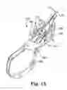 Fig. 08 - Anastomosis device configurations and methods