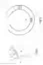 Fig. 04 - Dynamic reinforcement of the lower esophageal sphincter