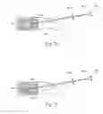 Fig. 11 - METHODS AND DEVICES FOR TREATING FRACTURED AND/OR DISEASED BONE