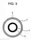 Fig. 04 - Balloon catheter and method of manufacturing the same