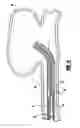 Fig. 05 - Stretch resistant embolic coil delivery system with mechanical release mechanism