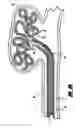 Fig. 07 - Stretch resistant embolic coil delivery system with mechanical release mechanism