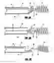 Fig. 04 - Stretch resistant embolic coil delivery system with mechanical release mechanism
