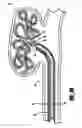 Fig. 06 - Stretch resistant embolic coil delivery system with mechanical release mechanism