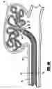 Fig. 06 - Stretch resistant embolic coil delivery system with mechanical release mechanism