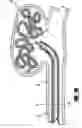 Fig. 06 - Stretch resistant embolic coil delivery system with mechanical release mechanism
