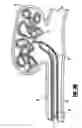 Fig. 07 - Stretch resistant embolic coil delivery system with mechanical release mechanism