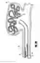 Fig. 08 - Stretch resistant embolic coil delivery system with mechanical release mechanism