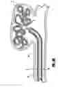 Fig. 06 - Stretch resistant embolic coil delivery system with mechanical release mechanism