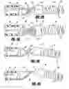 Fig. 04 - Stretch resistant embolic coil delivery system with mechanical release mechanism