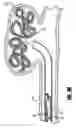 Fig. 08 - Stretch resistant embolic coil delivery system with spring release mechanism