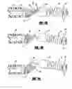 Fig. 04 - Stretch resistant embolic coil delivery system with spring assisted release mechanism