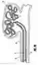 Fig. 06 - Stretch resistant embolic coil delivery system with spring release mechanism
