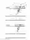 Fig. 03 - Hemostatic wire guided bandage and method of use