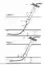 Fig. 09 - Vascular puncture sealing method, apparatus, and system