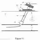Fig. 13 - Vascular puncture sealing method, apparatus, and system