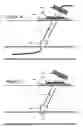 Fig. 14 - Vascular puncture sealing method, apparatus, and system