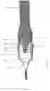 Fig. 19 - Vascular puncture sealing method, apparatus, and system