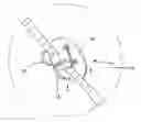 Fig. 01 - Septal defect closure device