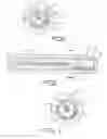 Fig. 04 - Septal defect closure device