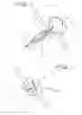 Fig. 07 - Septal defect closure device