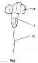 Fig. 02 - Methods and devices for treating dural puncture