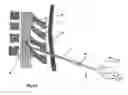 Fig. 05 - Methods and devices for treating dural puncture