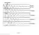 Fig. 04 - Method and apparatus for desynchronization of neural brain activity