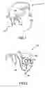 Fig. 02 - Method and apparatus for measuring the performance of an implantable middle ear hearing aid, and the response of a patient wearing such a hearing aid