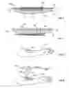 Fig. 05 - Skin treatment including patterned light