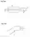 Fig. 04 - Non-invasive method and system for the treatment of snoring and nasal obstruction