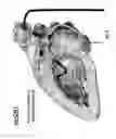 Fig. 09 - Methods and devices for mapping the ventricle for pacing lead placement and therapy delivery