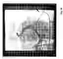 Fig. 11 - Methods and devices for mapping the ventricle for pacing lead placement and therapy delivery