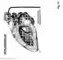 Fig. 14 - Methods and devices for mapping the ventricle for pacing lead placement and therapy delivery