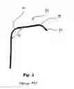 Fig. 03 - Coronary sinus lead for pacing the left atrium