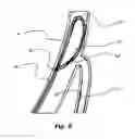 Fig. 07 - Coronary sinus lead for pacing the left atrium