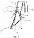 Fig. 06 - Coronary sinus lead for pacing the left atrium