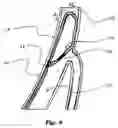 Fig. 07 - Coronary sinus lead for pacing the left atrium