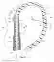 Fig. 10 - Coronary sinus lead for pacing the left atrium