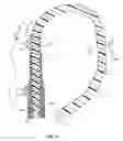 Fig. 12 - Coronary sinus lead for pacing the left atrium