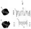 Fig. 03 - Methods of implanting a prosthesis and treating an aneurysm