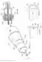 Fig. 09 - Methods of implanting a prosthesis and treating an aneurysm