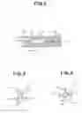 Fig. 03 - Stent placement device