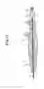 Fig. 11 - Stent placement device