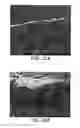 Fig. 17 - Dealloyed nanoporous stents