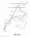Fig. 19 - Dealloyed nanoporous stents